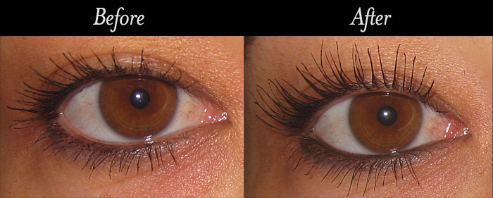 lilash-before-after__43643