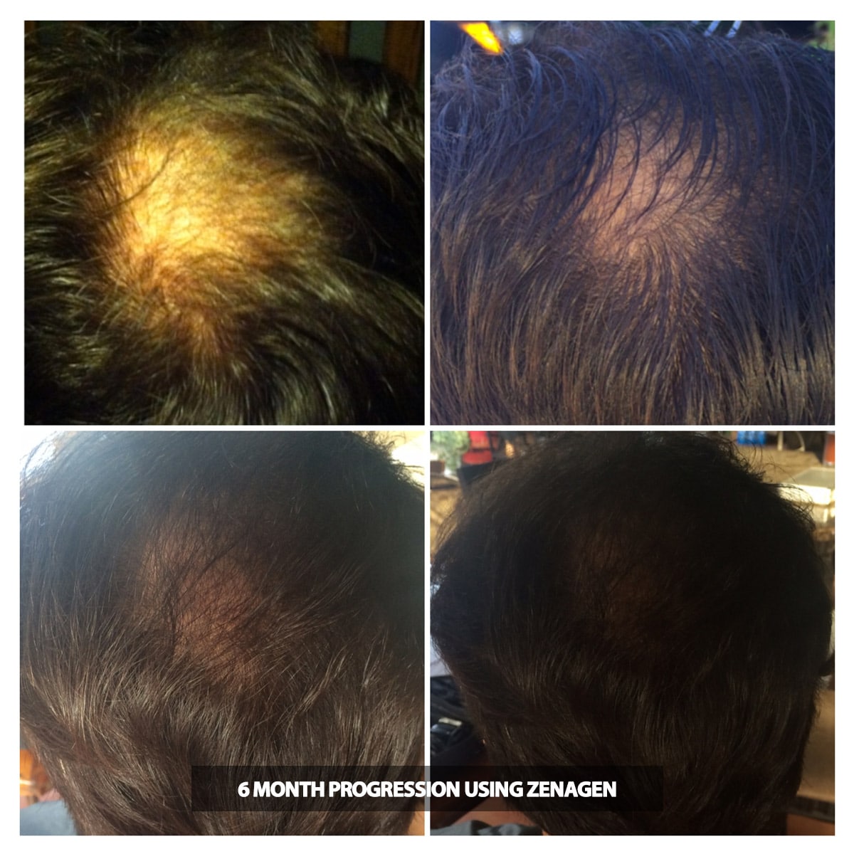 Zenagen shampoo on sale